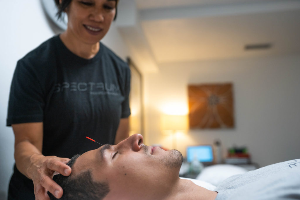 Acupuncture Baldwin Park, Orlando