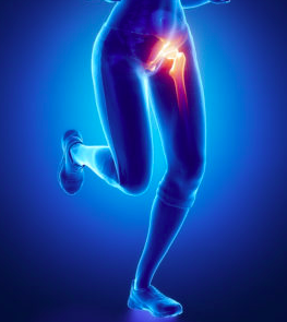 Anterior Hip Pain: Do you have Femoroacetabular Impingement (FAI)?